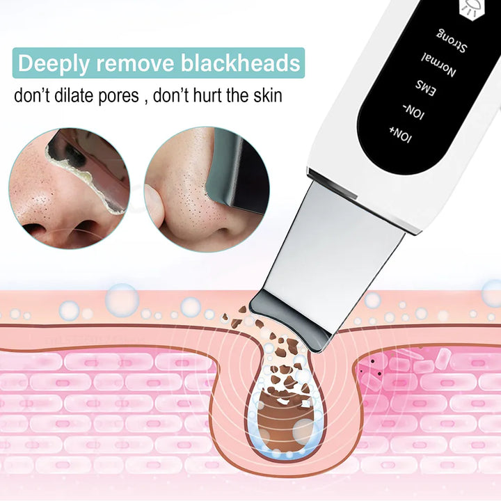 Ultrasonic Blackhead Remover